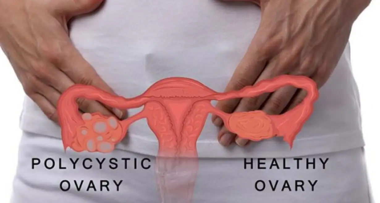 Ask a Gynecologist Online for Bumps On Inner Thigh